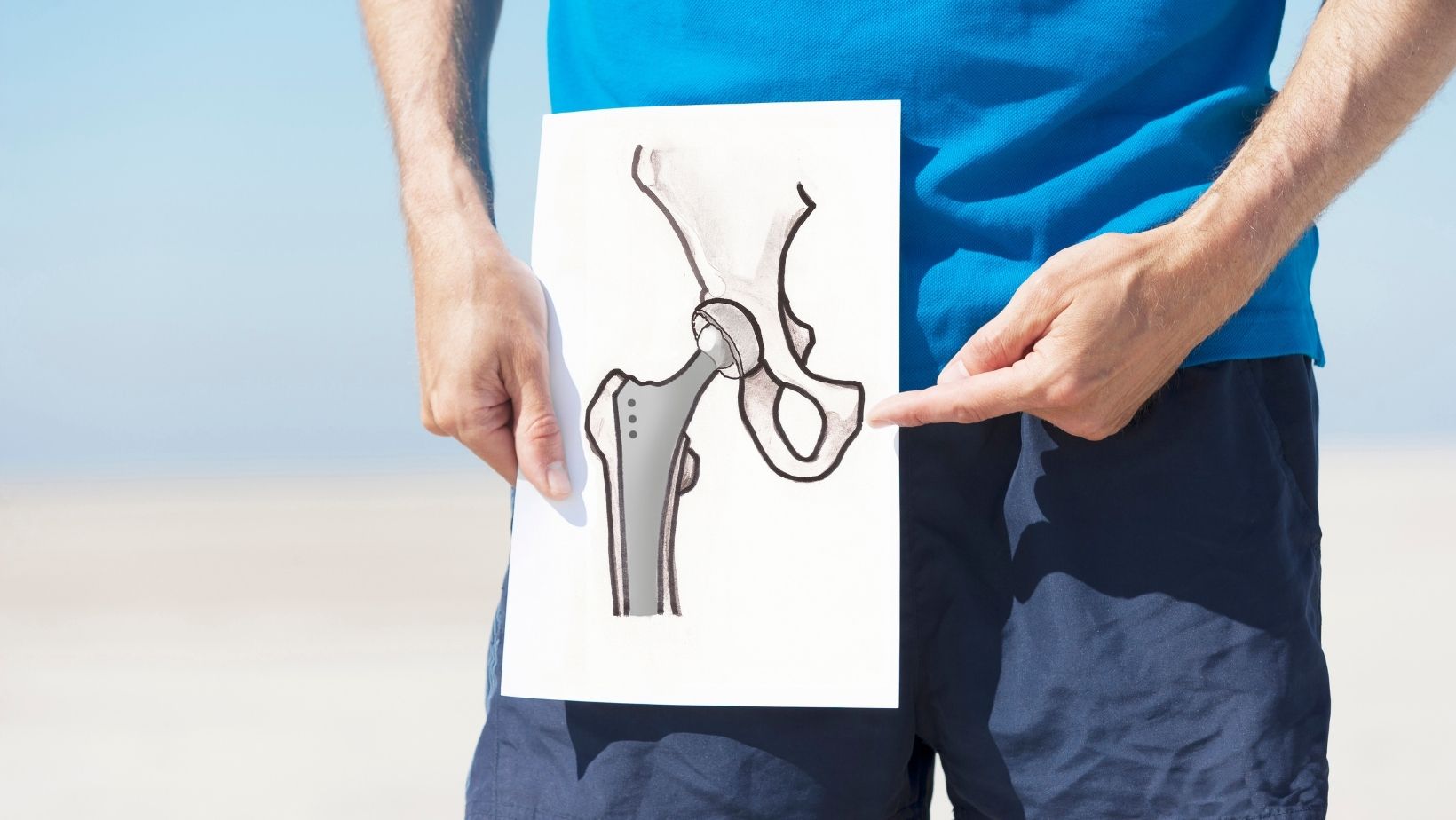 A man pointing at a diagram of an artificial hip.