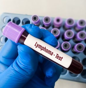 Blood sample for Lymphoma test. Cutaneous T-Cell Lymphoma, a form of Non-Hodgkin Lymphoma.